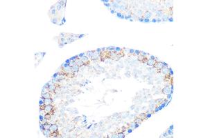 Immunohistochemistry of paraffin-embedded mouse testis using MSR1 Rabbit mAb (ABIN7268353) at dilution of 1:100 (40x lens). (Macrophage Scavenger Receptor 1 抗体)
