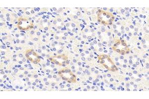 Detection of CTTN in Rat Kidney Tissue using Polyclonal Antibody to Cortactin (CTTN) (Cortactin 抗体  (AA 1-509))