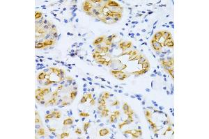 Immunohistochemistry of paraffin-embedded human stomach using CYP2E1 antibody (ABIN5971187) at dilution of 1/100 (40x lens). (CYP2E1 抗体)