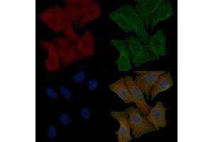 CHCHD6 Mouse Monoclonal Antibody staining Hela cells by IF/ICC. (CHCHD6 抗体  (Internal Region))