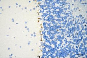 Immunohistochemistry was performed on paraffin-embedded mouse brain using SOX9 antibody (ABIN7800973), 1:200).