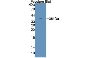 Western blot analysis of the recombinant protein. (Tensin 1 抗体  (AA 4-307))