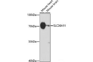 Western blot analysis of extracts of various cell lines using SLC26A11 Polyclonal Antibody at dilution of 1:1000. (SLC26A11 抗体)