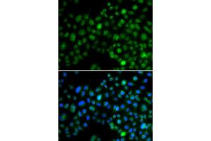 Immunofluorescence analysis of MCF7 cell using NFIL3 antibody. (NFIL3 抗体)