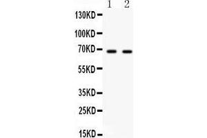 Western Blotting (WB) image for anti-Polo-Like Kinase 1 (PLK1) (AA 86-430) antibody (ABIN3043354) (PLK1 抗体  (AA 86-430))