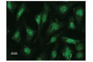 Immunostaining analysis in HeLa cells. (USF2 抗体)