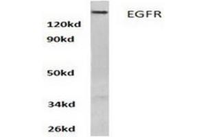 Image no. 1 for anti-Epidermal Growth Factor Receptor (EGFR) antibody (ABIN265397) (EGFR 抗体)