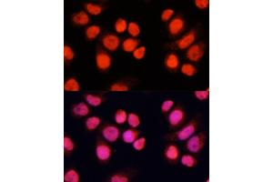 Immunofluorescence analysis of Hela cells using CH antibody (ABIN6127698, ABIN6138485, ABIN6138486 and ABIN6215383) at dilution of 1:100 (40x lens). (ZNF828 抗体  (AA 563-812))