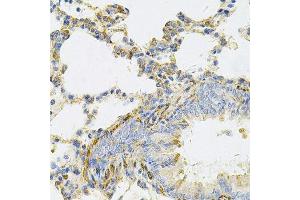 Immunohistochemistry of paraffin-embedded rat lung using UBE2B Antibody. (UBE2B 抗体  (AA 1-152))