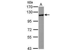 Image no. 2 for anti-Huntingtin Interacting Protein 1 Related (HIP1R) (N-Term) antibody (ABIN1494032) (HIP1R 抗体  (N-Term))