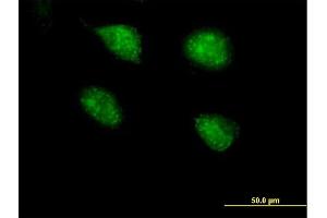 Immunofluorescence of purified MaxPab antibody to PPP2R3B on HeLa cell. (PPP2R3B 抗体  (AA 1-176))