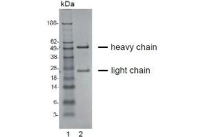 SDS-PAGE (SDS) image for anti-Chemokine (C-C Motif) Receptor 4 (CCR4) antibody (ABIN179723)