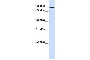 Western Blotting (WB) image for anti-Anoctamin 10 (ANO10) antibody (ABIN2459104)