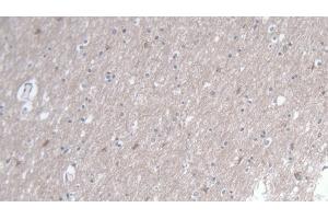 Immunohistochemistry (IHC) image for anti-Toll-Interleukin 1 Receptor (TIR) Domain Containing Adaptor Protein (TIRAP) (AA 1-221) antibody (ABIN7441712)