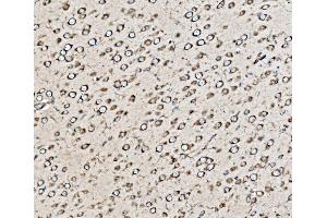 IHC analysis of Kinectin 1/KTN1 using anti-Kinectin 1/KTN1 antibody (ABIN7601096).