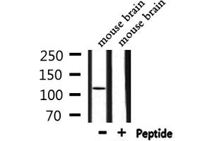 Western blot analysis of extracts from mouse brain, using ZC3H7B Antibody. (ZC3H7B 抗体  (C-Term))