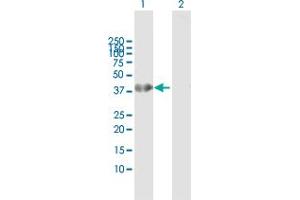 Western Blot analysis of HOXA1 expression in transfected 293T cell line by HOXA1 MaxPab polyclonal antibody. (HOXA1 抗体  (AA 1-335))
