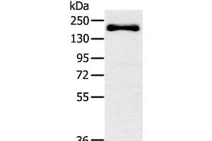 Western Blot analysis of Mouse bladder tissue using SLIT2 Polyclonal Antibody at dilution of 1:200 (SLIT2 抗体)