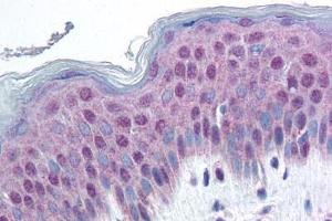 Human Skin (formalin-fixed, paraffin-embedded) stained with HMGN1 antibody ABIN214463 at 20 ug/ml followed by biotinylated goat anti-rabbit IgG secondary antibody ABIN481713, alkaline phosphatase-streptavidin and chromogen. (HMGN1 抗体  (pSer20, Ser24))