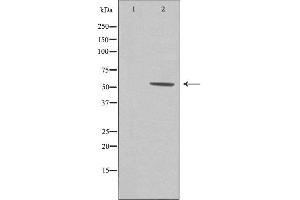 Western blot analysis of extracts from Jurkat cells using CA181 antibody. (ZNHIT6 抗体  (Internal Region))