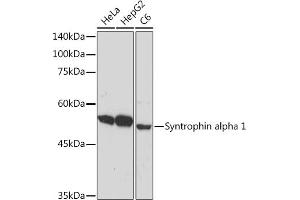 Western blot analysis of extracts of various cell lines, using Syntrophin alpha 1 Rabbit mAb (ABIN7270691) at 1:1000 dilution. (SNTA1 抗体)