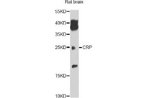 Western blot analysis of extracts of rat brain, using CRP antibody. (CRP 抗体)