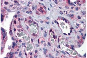 Human Placenta: Formalin-Fixed, Paraffin-Embedded (FFPE) (G3BP1 抗体  (AA 136-185))