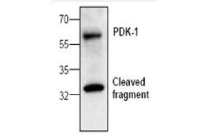 Image no. 1 for anti-3-phosphoinositide Dependent Protein Kinase-1 (PDPK1) antibody (ABIN127128) (PDPK1 抗体)