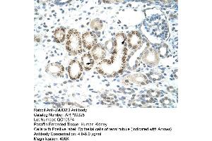 Human kidney (JMJD2D 抗体  (C-Term))