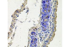 Immunohistochemistry of paraffin-embedded Mouse lung using SKP1 Polyclonal Antibody at dilution of 1:100 (40x lens). (SKP1 抗体)