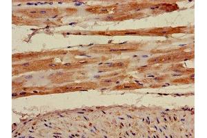 Immunohistochemistry of paraffin-embedded human heart tissue using ABIN7142910 at dilution of 1:100 (AKAP7 抗体  (AA 1-81))