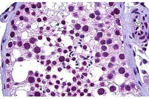 Human Testis: Formalin-Fixed, Paraffin-Embedded (FFPE) (WT1 抗体  (AA 349-439))