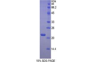 SDS-PAGE analysis of Mouse Hemoglobin beta Protein. (Hemoglobin Subunit beta 蛋白)