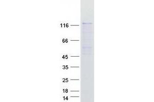 Western Blotting (WB) image for SMC6 Structural Maintenance of Chromosomes 6-Like 1 (SMC6) (Transcript Variant 2) protein (Myc-DYKDDDDK Tag) (ABIN2732242)