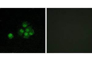 P-peptide - +Immunofluorescence analysis of MCF7 cells, using IRS-1 (Phospho-Ser636) antibody.
