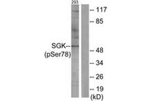 Western blot analysis of extracts from 293 cells treated with UV 15', using SGK (Phospho-Ser78) Antibody. (SGK1 抗体  (pSer78))