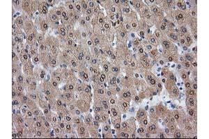 Image no. 3 for anti-Alcohol Dehydrogenase 1B (Class I), beta Polypeptide (ADH1B) antibody (ABIN1496479) (ADH1B 抗体)