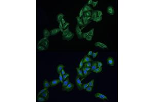 Immunofluorescence analysis of U2OS cells using AGTRAP Rabbit pAb (ABIN6130822, ABIN6136657, ABIN6136658 and ABIN6215773) at dilution of 1:100 (40x lens). (AGTRAP 抗体  (AA 93-152))