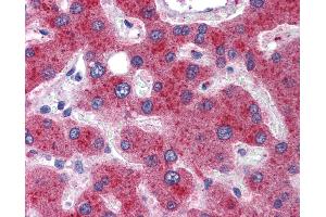 Immunohistochemistry (IHC) image for anti-Methylenetetrahydrofolate Dehydrogenase (NADP+ Dependent) 1, Methenyltetrahydrofolate Cyclohydrolase, Formyltetrahydrofolate Synthetase (MTHFD1) (AA 74-123) antibody (ABIN6747102)