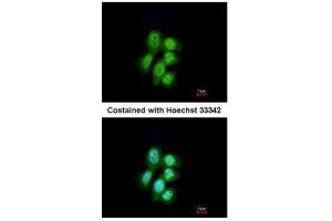 Immunofluorescence (IF) image for anti-Major Vault Protein (MVP) antibody (ABIN2856921)