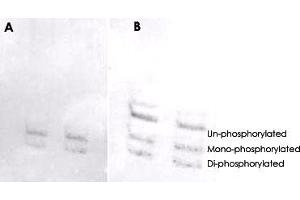 MYL6 (phospho S19/20) polyclonal antibody  was used at a 1 : 1000 dilution to detect myosin light chain by Western blot on NIH/3T3 cell lysates. (MYL6 抗体  (pSer19, pSer20))