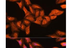 Immunofluorescence analysis of U2OS cells using BGLAP Polyclonal Antibody at dilution of 1:100. (Osteocalcin 抗体)