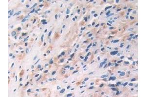 Immunohistochemistry (IHC) image for anti-Interleukin 33 (IL33) (AA 112-270) antibody (ABIN7426418)