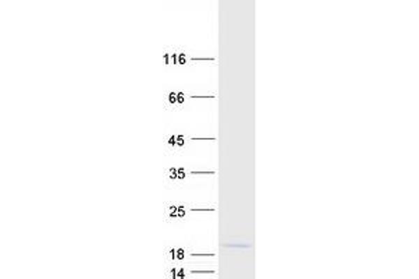 SMPX Protein (Myc-DYKDDDDK Tag)