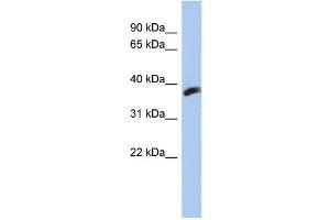 WB Suggested Anti-CYB5RL Antibody Titration: 0. (CYB5RL 抗体  (N-Term))