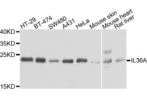 Western blot analysis of extracts of various cell lines, using IL36A antibody. (IL36A/IL1F6 抗体)