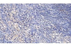 Immunohistochemistry (IHC) image for anti-Superoxide Dismutase 1, Soluble (SOD1) (AA 2-154) antibody (ABIN7429208)