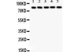 Western Blotting (WB) image for anti-SRY (Sex Determining Region Y)-Box 5 (SOX5) (AA 495-528), (C-Term) antibody (ABIN3043348) (SOX5 抗体  (C-Term))