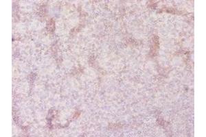Immunohistochemistry of paraffin-embedded human tonsil tissue using ABIN7170251 at dilution of 1:20 (SLC41A2 抗体  (AA 1-162))