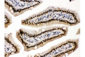 Immunohistochemistry (IHC) image for anti-Protein Kinase, AMP-Activated, beta 2 Non-Catalytic Subunit (PRKAB2) (AA 56-89), (N-Term) antibody (ABIN3043907)